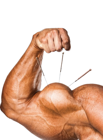 Acupuntura e Esportes Musculação