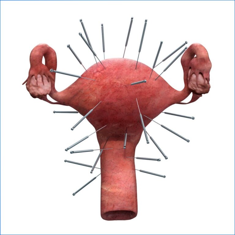 Benefícios da Acupuntura para a Fertilidade Benefícios da Acupuntura para a Fertilidade
