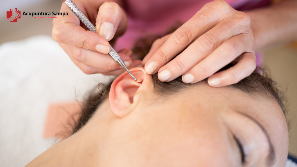 Pontos Específicos da Acupuntura Que Tendem a Sangrar Mais