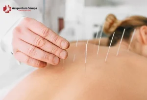 Acupuntura Sampa
