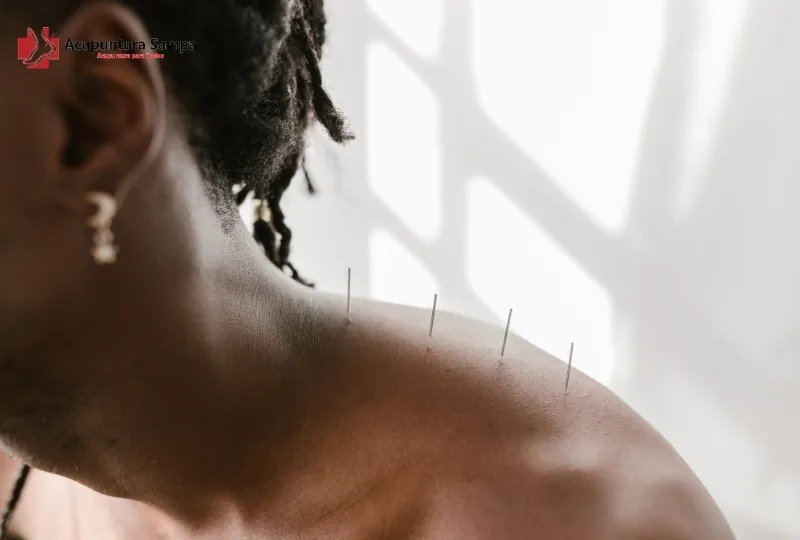 Acupuntura ajuda a melhorar a postura corporal e a consciência corporal?