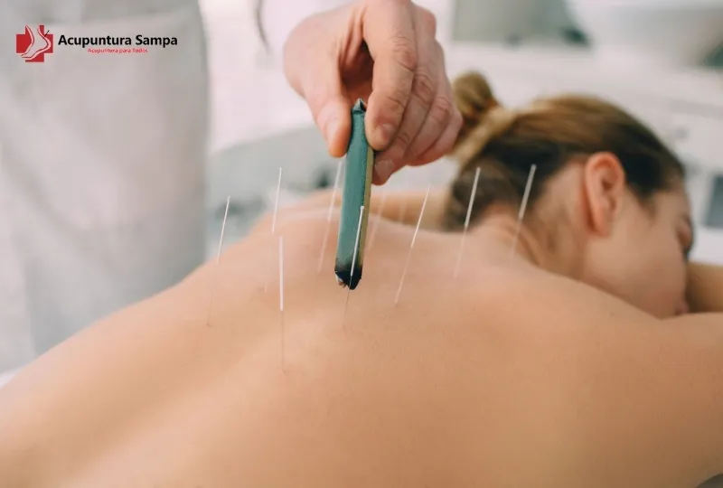 É Necessário Ter Formação Médica para Ser Acupunturista na Europa? Entenda a Legislação por País