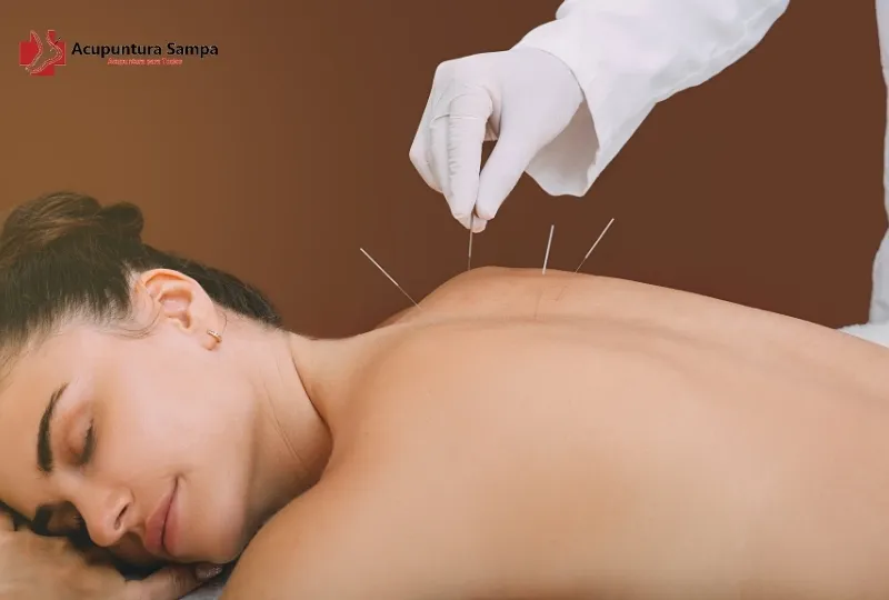 Acupuntura Tem o Mesmo Efeito em Todas as Pessoas? Veja as Diferenças Individuais