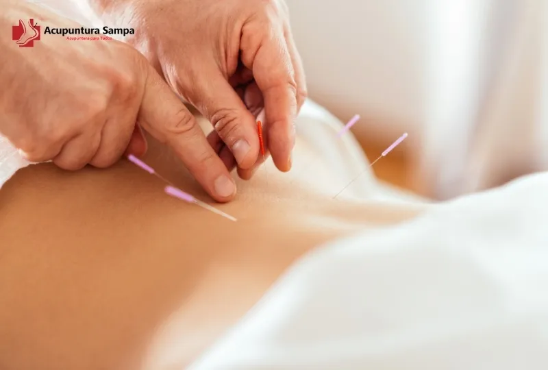 Acupuntura Ajuda em Casos de Fibromialgia? Descubra o Alívio Real