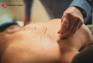 Acupuntura Sampa