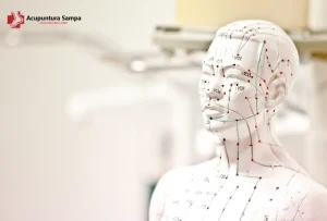 Acupuntura Sampa