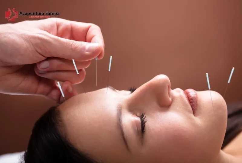 A acupuntura é indicada para quem sofre com refluxo gástrico?