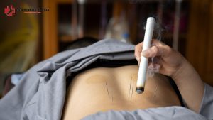 Origem e história da moxabustão na medicina tradicional chinesa