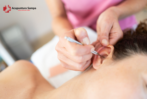 Auriculoterapia Acupuntura.Sampa.br