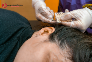 Auriculoterapia Acupuntura.Sampa.br