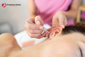 Auriculoterapia Acupuntura.Sampa.br