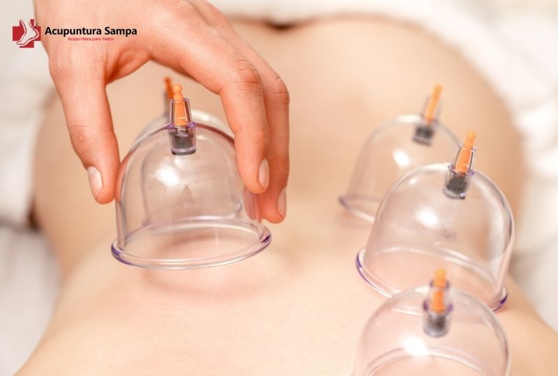 Ventosaterapia na Medicina Tradicional Chinesa
