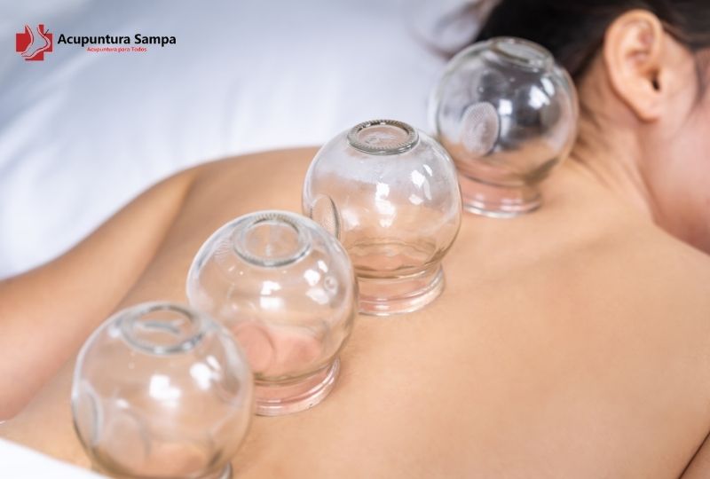 Como montar um espaço profissional de ventosaterapia?