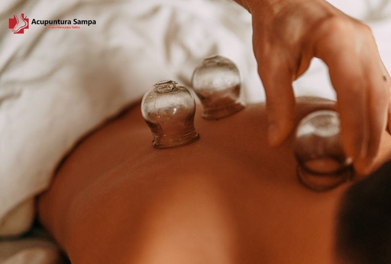 Ventosaterapia para artrite e artrose: tem benefícios?