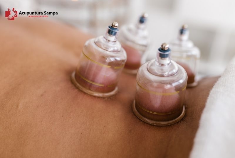 Ventosaterapia com ventosas de silicone, acrílico ou vidro: qual escolher?